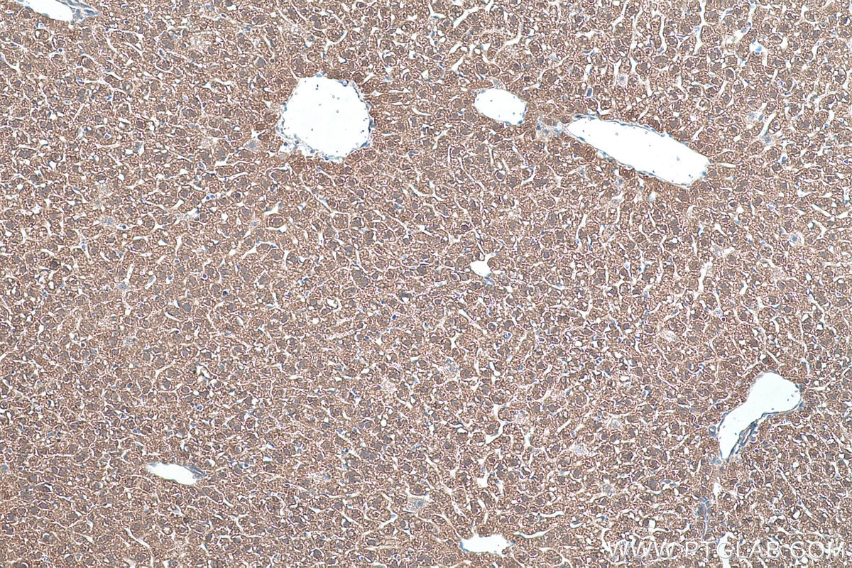 Immunohistochemical analysis of paraffin-embedded mouse liver tissue slide using KHC0392 (ABHD14B IHC Kit).