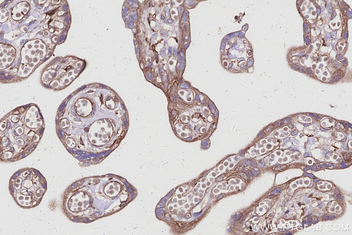 Immunohistochemical analysis of paraffin-embedded human placenta tissue slide using KHC2974 (ABI2 IHC Kit).