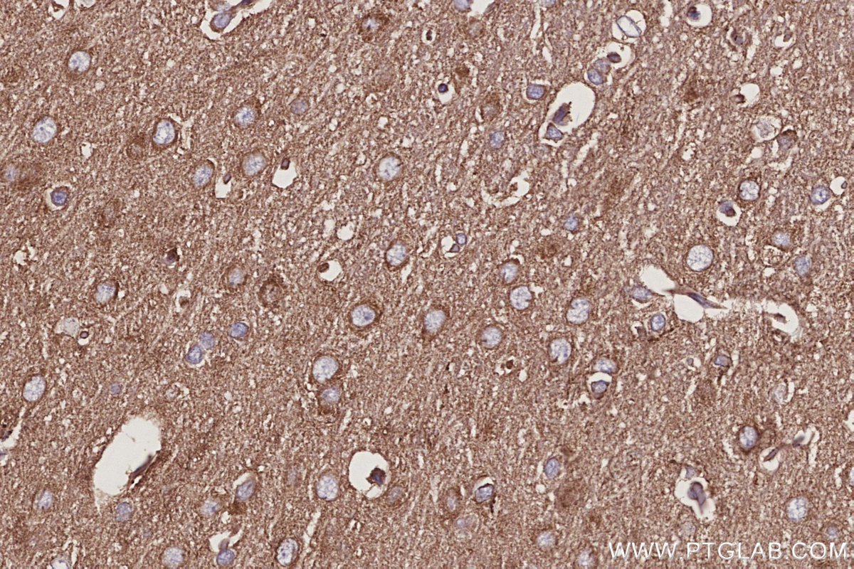 Immunohistochemical analysis of paraffin-embedded rat brain tissue slide using KHC2974 (ABI2 IHC Kit).