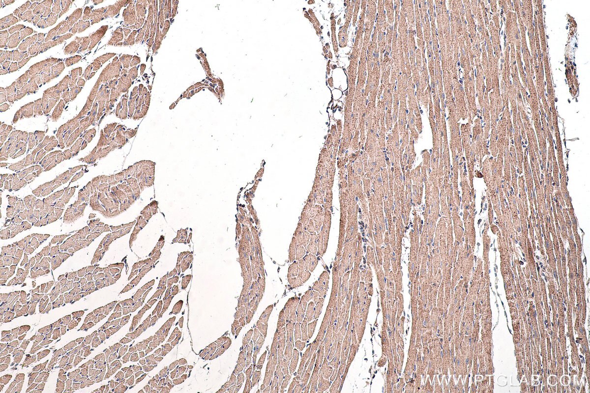 Immunohistochemical analysis of paraffin-embedded mouse heart tissue slide using KHC0555 (ACAA1 IHC Kit).