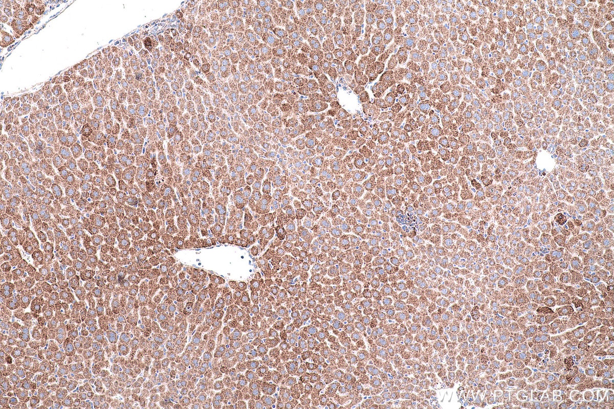 Immunohistochemical analysis of paraffin-embedded mouse liver tissue slide using KHC0555 (ACAA1 IHC Kit).
