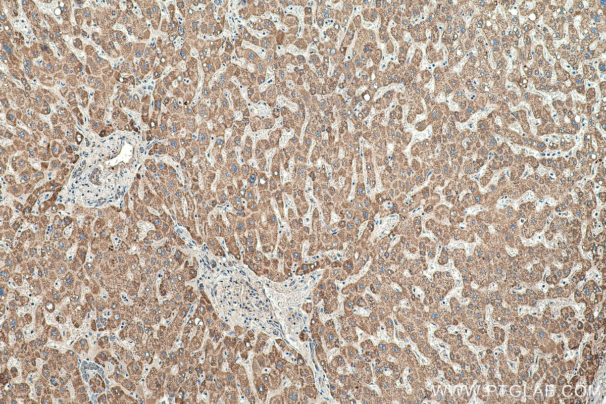 Immunohistochemical analysis of paraffin-embedded human liver tissue slide using KHC0502 (ACAA2 IHC Kit).