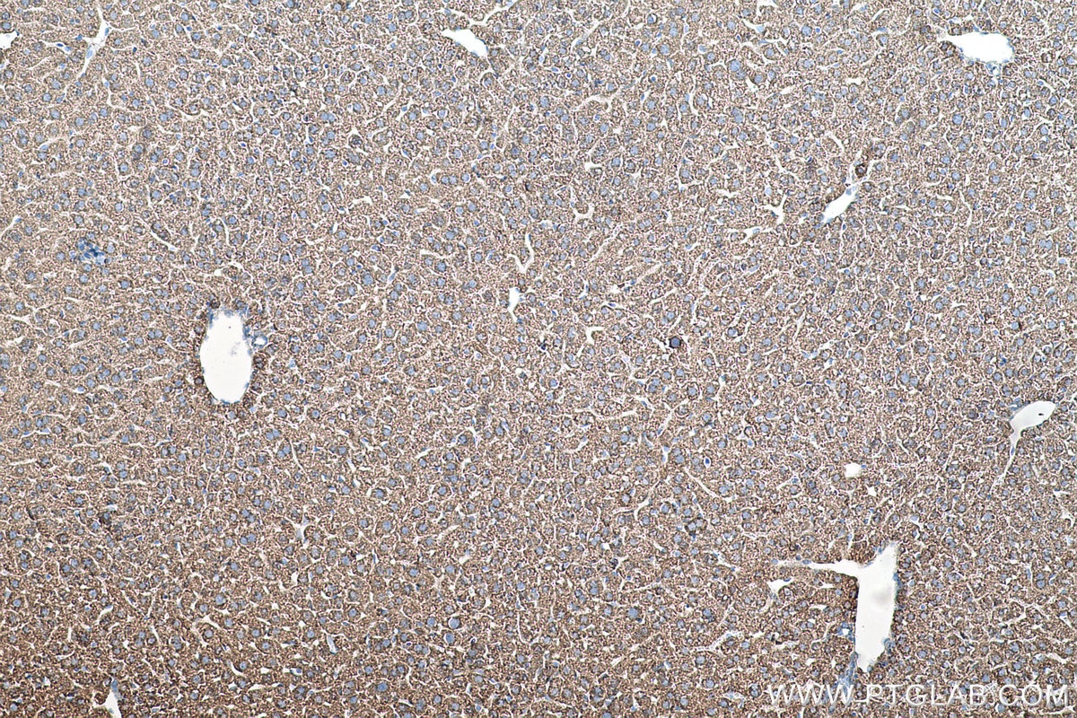 Immunohistochemical analysis of paraffin-embedded mouse liver tissue slide using KHC0502 (ACAA2 IHC Kit).