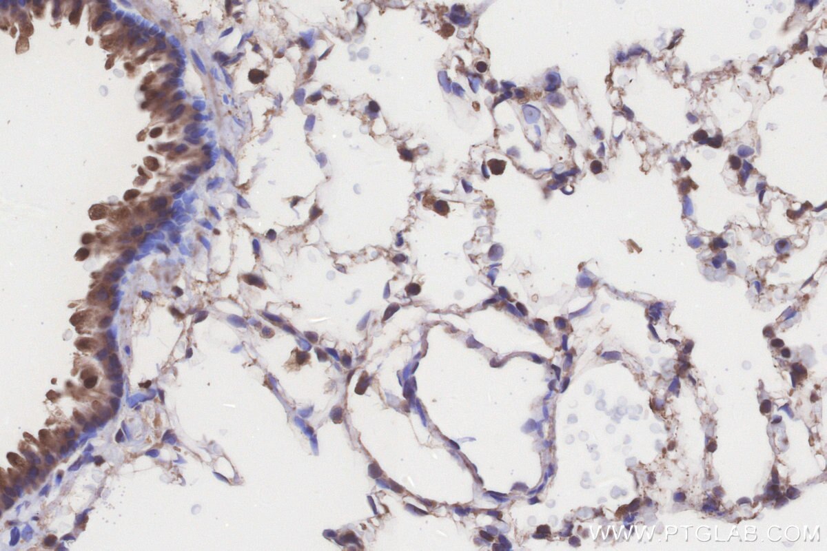 Immunohistochemical analysis of paraffin-embedded rat lung tissue slide using KHC3205 (ACADL IHC Kit). Immunohistochemical analysis of paraffin-embedded rat lung tissue slide using KHC3205 (ACADL IHC Kit).