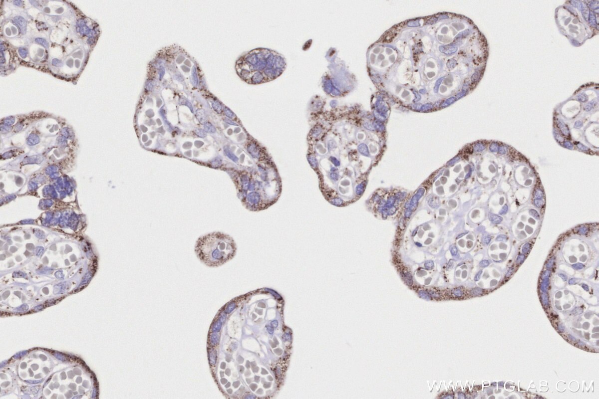 Immunohistochemical analysis of paraffin-embedded human placenta tissue slide using KHC3189 (ACADS IHC Kit). Immunohistochemical analysis of paraffin-embedded human placenta tissue slide using KHC3189 (ACADS IHC Kit).