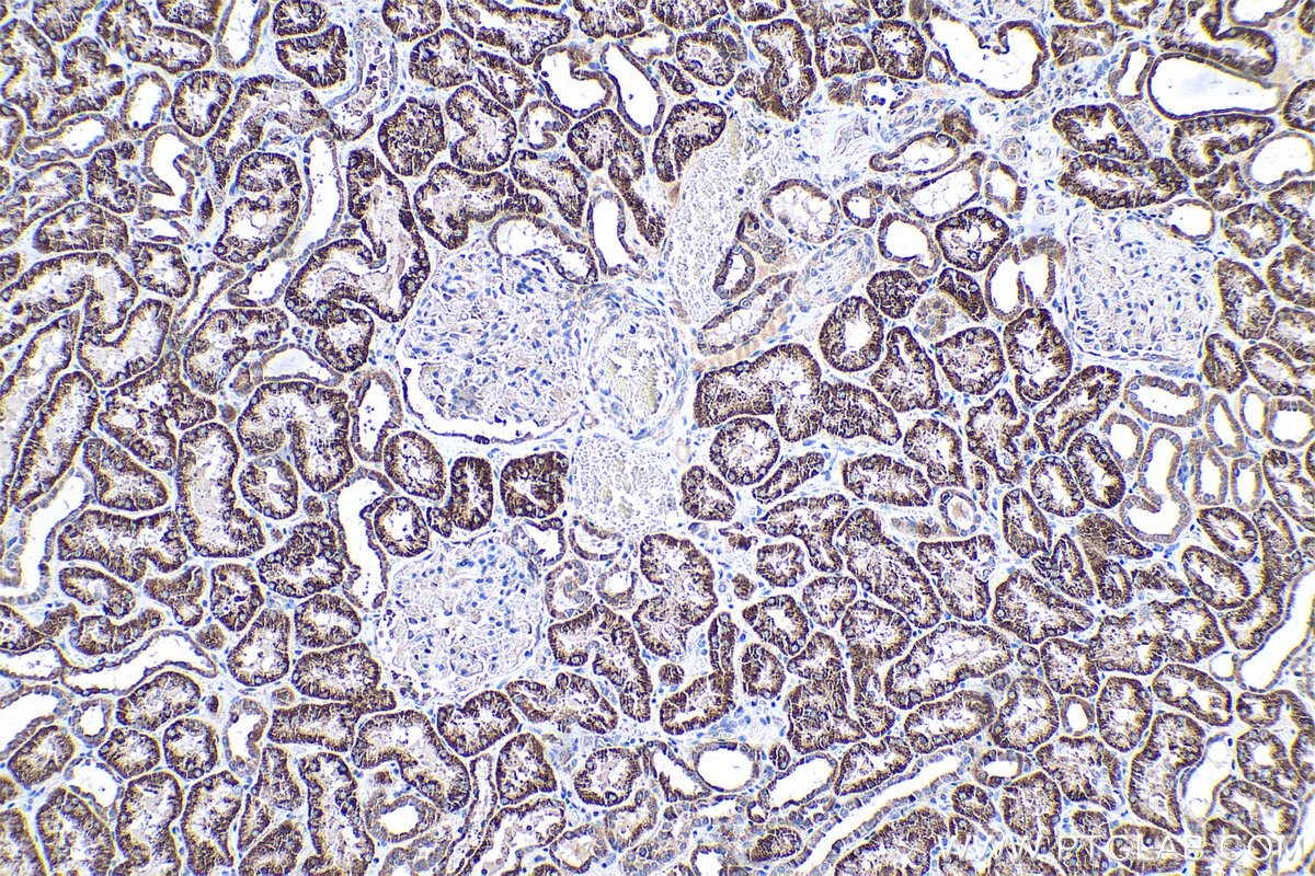 Immunohistochemical analysis of paraffin-embedded human kidney tissue slide using KHC0537 (ACADSB IHC Kit).