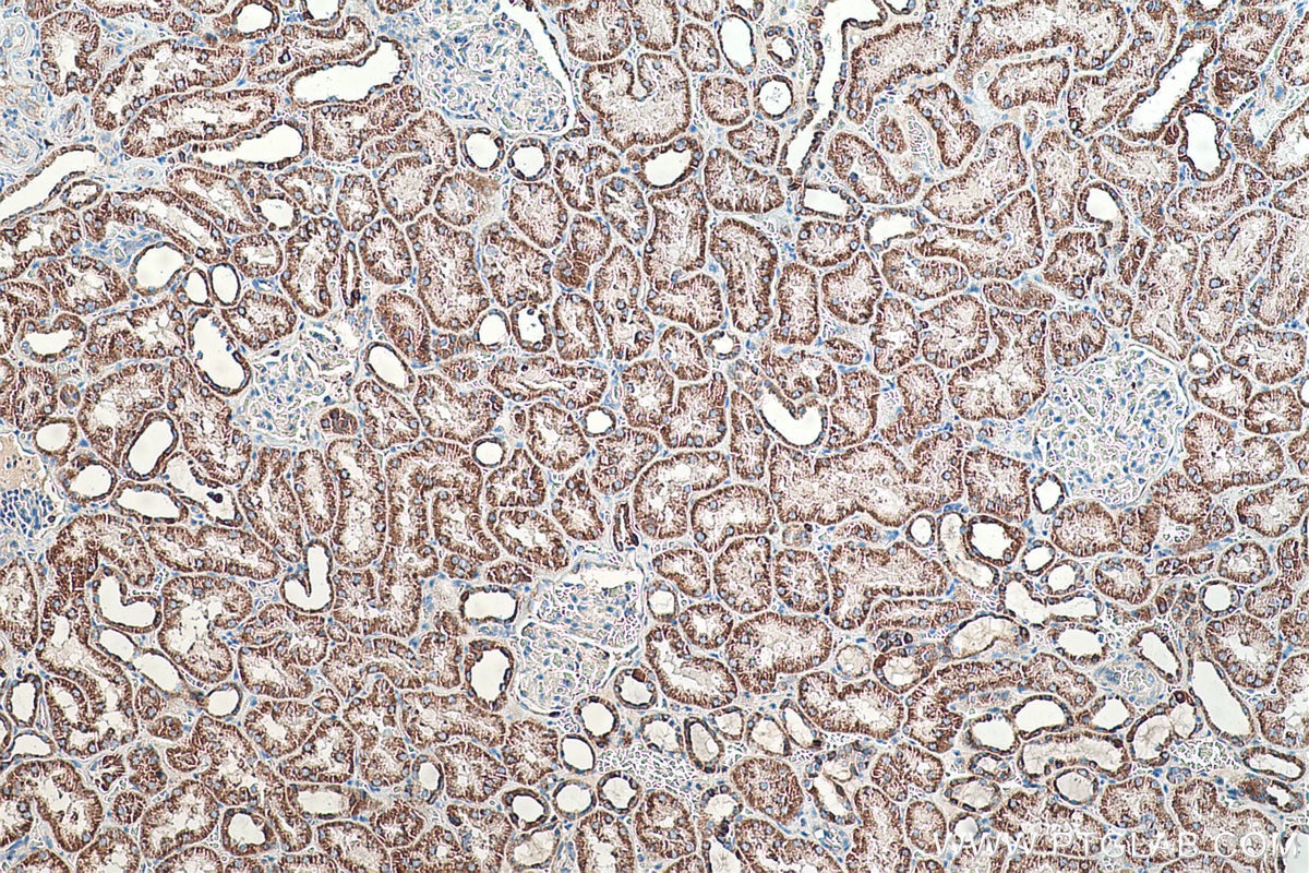 Immunohistochemical analysis of paraffin-embedded human kidney tissue slide using KHC0504 (ACAT1 IHC Kit).