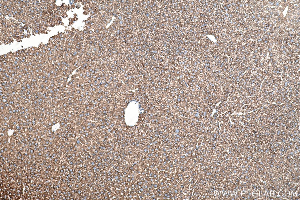 Immunohistochemical analysis of paraffin-embedded mouse liver tissue slide using KHC0504 (ACAT1 IHC Kit).