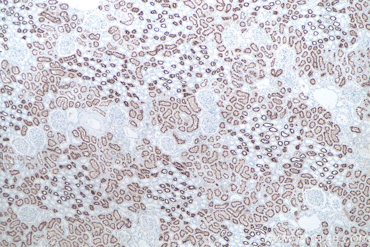 Immunohistochemical analysis of paraffin-embedded human kidney tissue slide using KHC0062 (ACE2 IHC Kit).