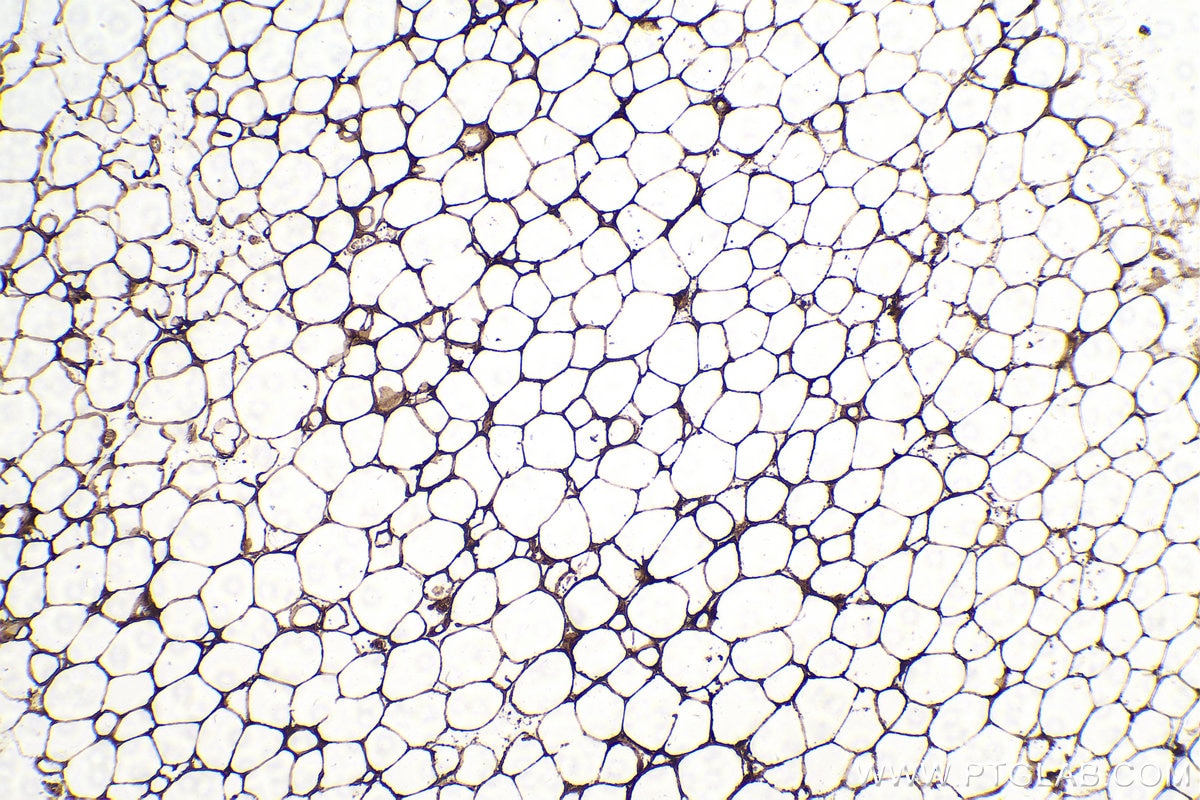 Immunohistochemical analysis of paraffin-embedded mouse brown adipose tissue slide using KHC0227 (ACLY IHC Kit).