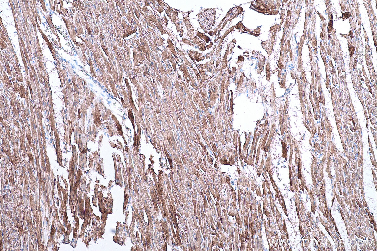 Immunohistochemical analysis of paraffin-embedded rat heart tissue slide using KHC0674 (ACO2 IHC Kit).