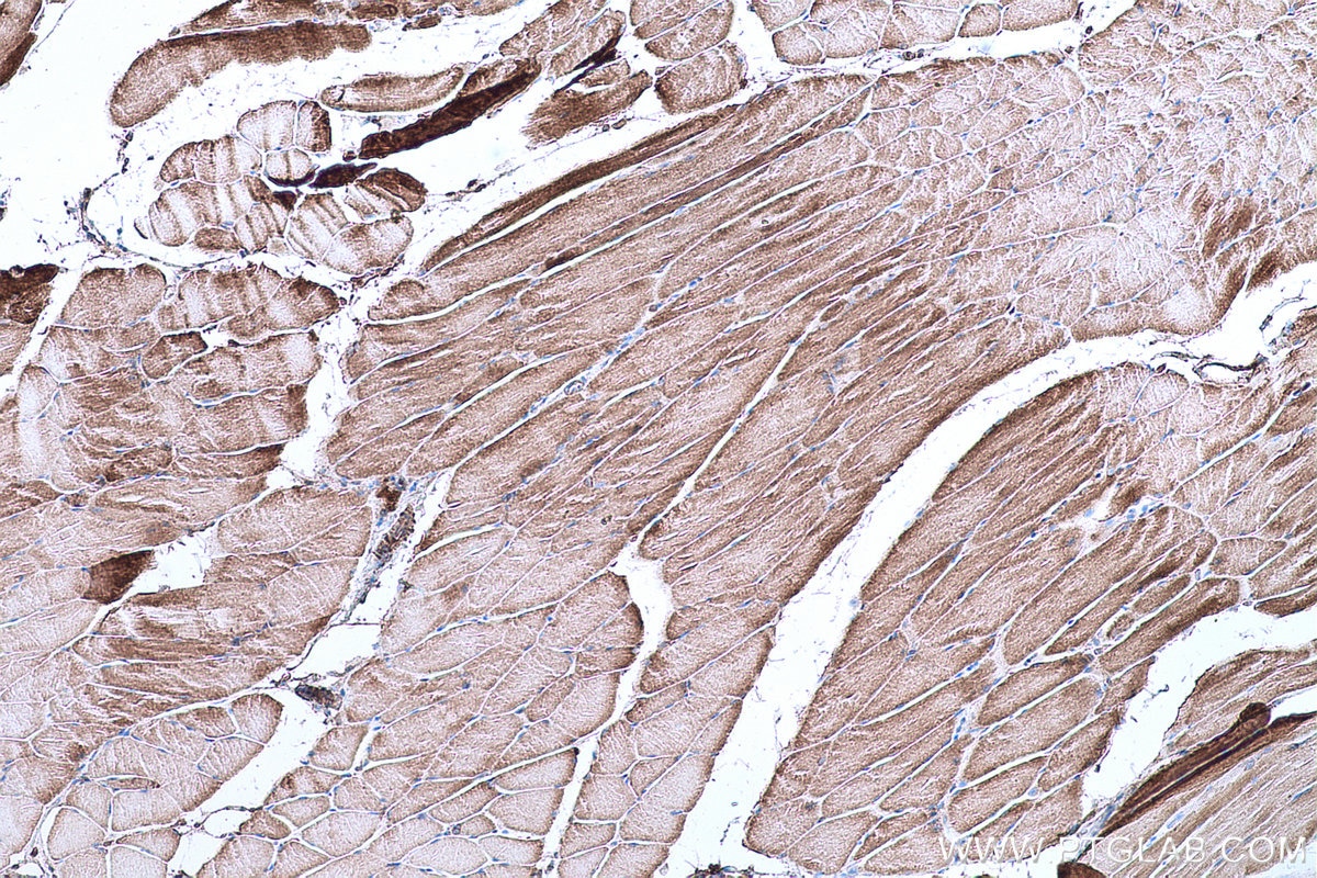 Immunohistochemical analysis of paraffin-embedded mouse skeletal muscle tissue slide using KHC0674 (ACO2 IHC Kit).