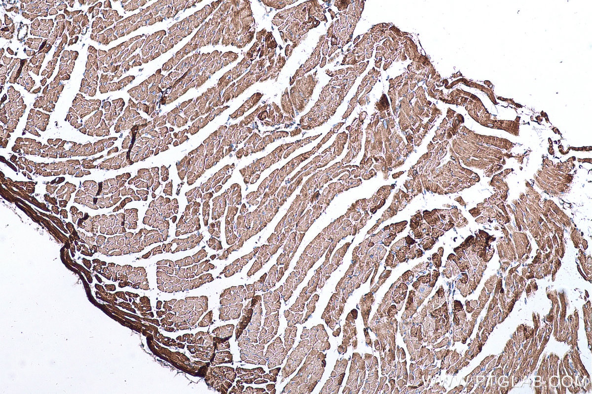 Immunohistochemical analysis of paraffin-embedded mouse heart tissue slide using KHC0674 (ACO2 IHC Kit).