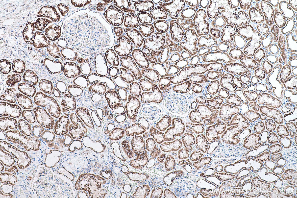 Immunohistochemical analysis of paraffin-embedded human kidney tissue slide using KHC0674 (ACO2 IHC Kit).