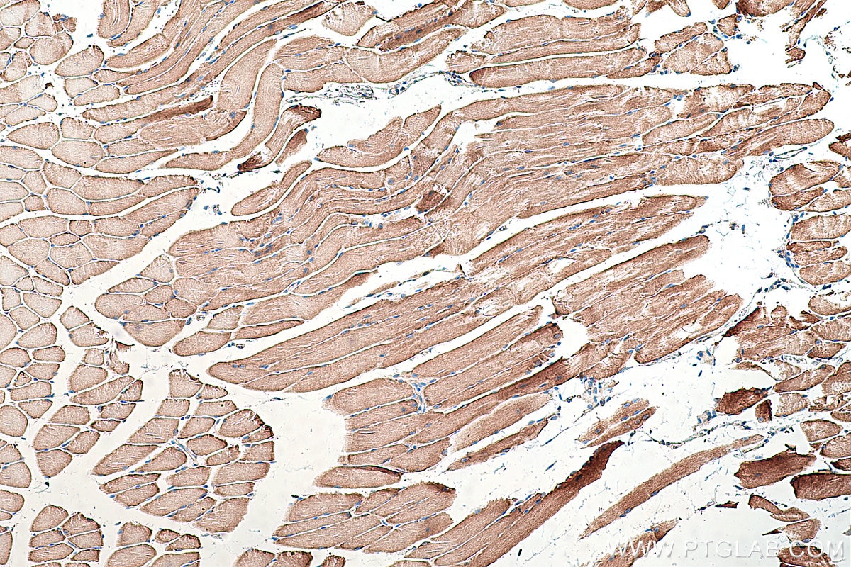 Immunohistochemical analysis of paraffin-embedded mouse skeletal muscle tissue slide using KHC0393 (ACSL1 IHC Kit).