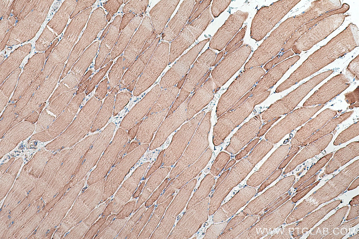 Immunohistochemical analysis of paraffin-embedded rat skeletal muscle tissue slide using KHC0393 (ACSL1 IHC Kit).