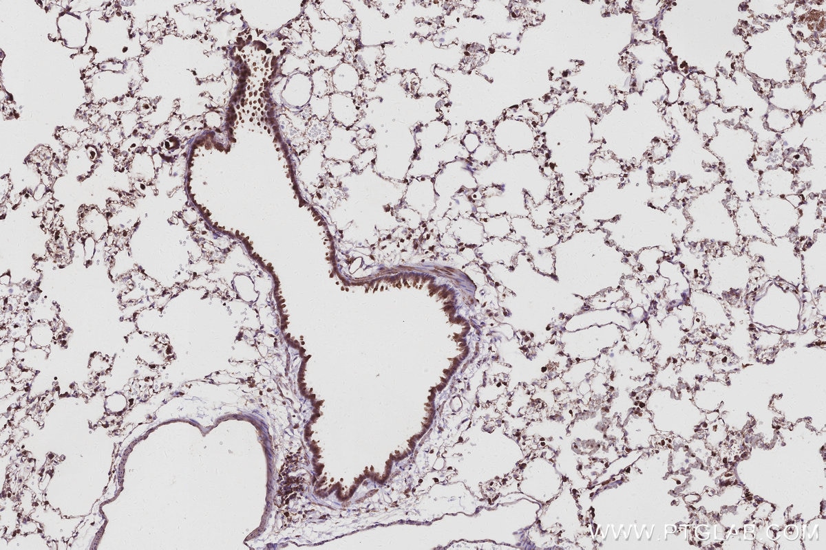 Immunohistochemical analysis of paraffin-embedded rat lung tissue slide using KHC3033 (ACSL5 IHC Kit).
