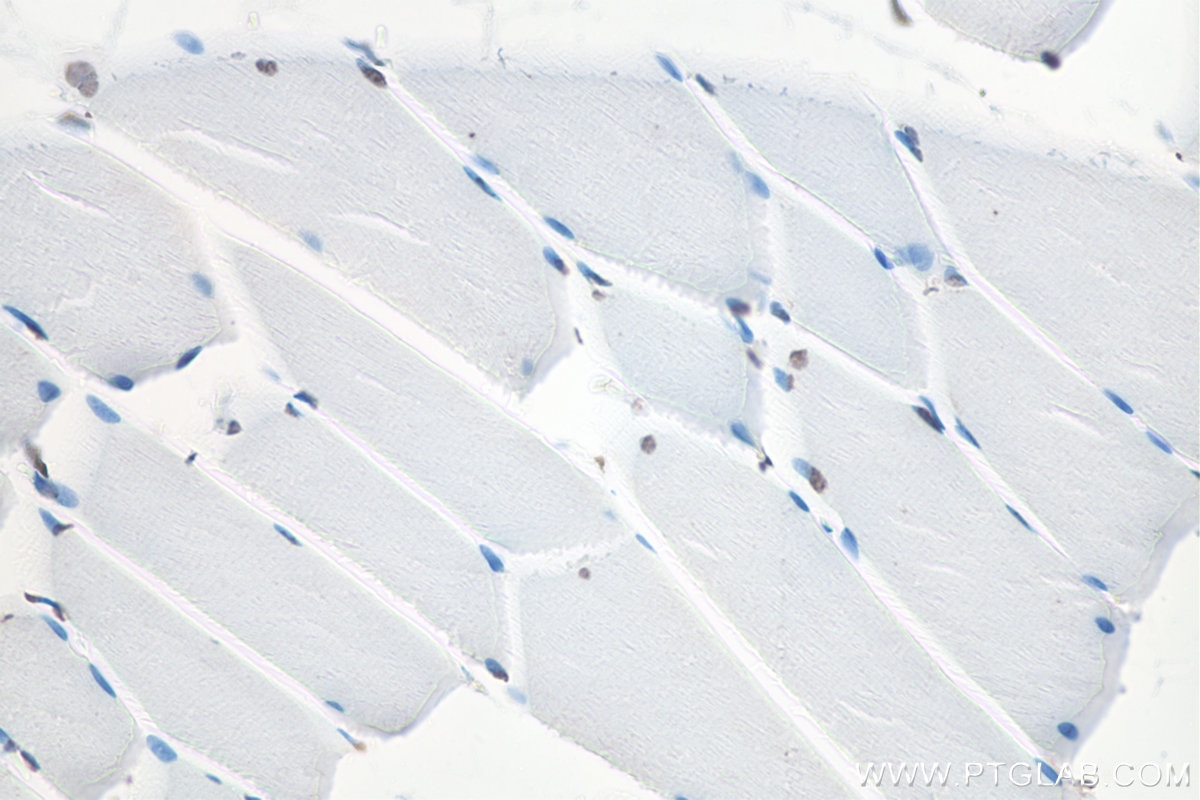 Immunohistochemical analysis of paraffin-embedded rat skeletal muscle tissue slide using KHC0101 (ACTC1-specific IHC Kit). Note that ACTC1 is not expressed in skeletal muscle. 