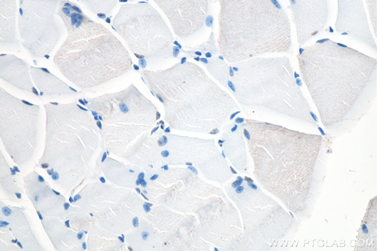 Immunohistochemical analysis of paraffin-embedded mouse skeletal muscle tissue slide using KHC0101 (ACTC1-specific IHC Kit). Note that ACTC1 is not expressed in skeletal muscle. 