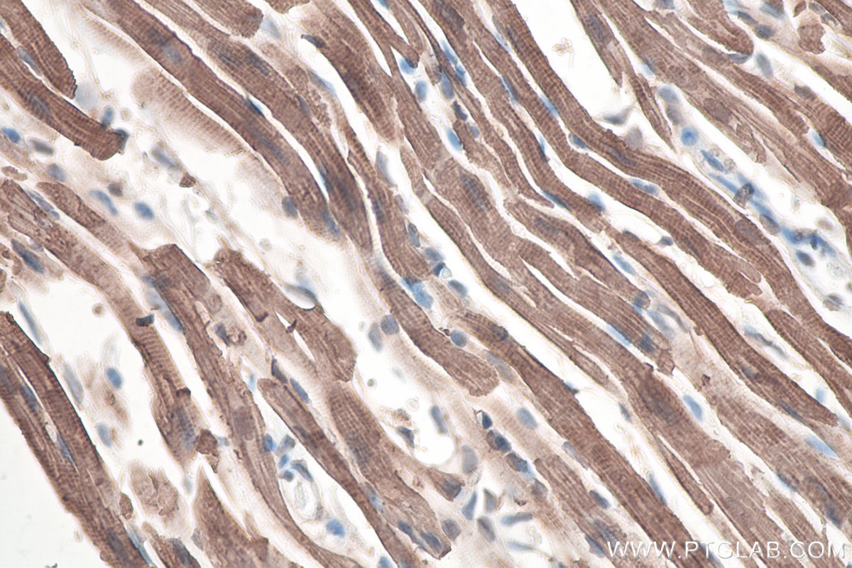 Immunohistochemical analysis of paraffin-embedded mouse heart tissue slide using KHC0101 (ACTC1-specific IHC Kit).