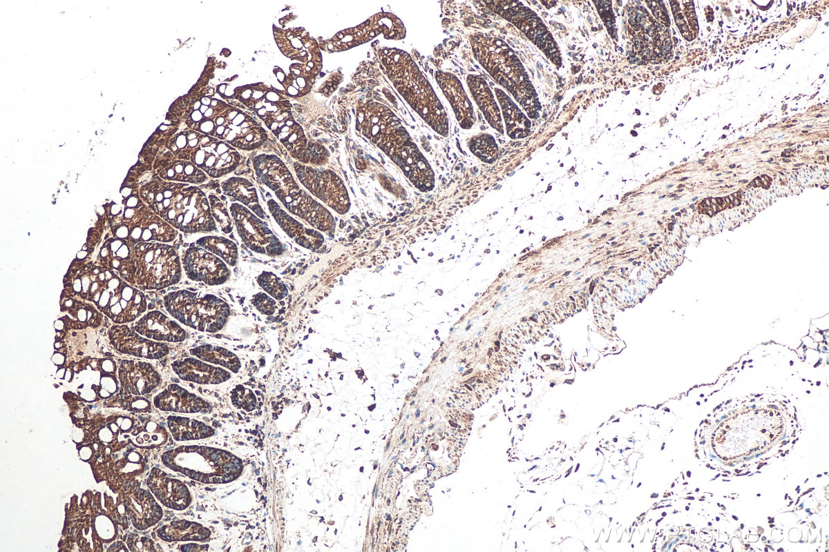 Immunohistochemical analysis of paraffin-embedded mouse colon tissue slide using KHC0512 (ACTG1 IHC Kit).