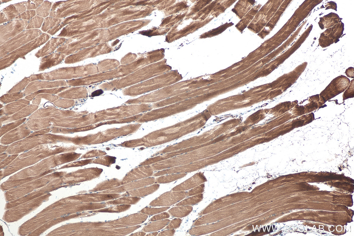Immunohistochemical analysis of paraffin-embedded mouse skeletal muscle tissue slide using KHC0512 (ACTG1 IHC Kit).