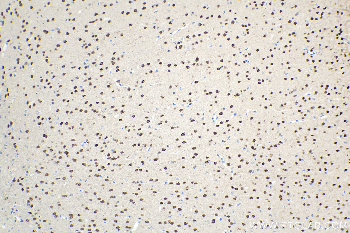 Immunohistochemical analysis of paraffin-embedded mouse brain tissue slide using KHC1482 (ACTL6B IHC Kit).