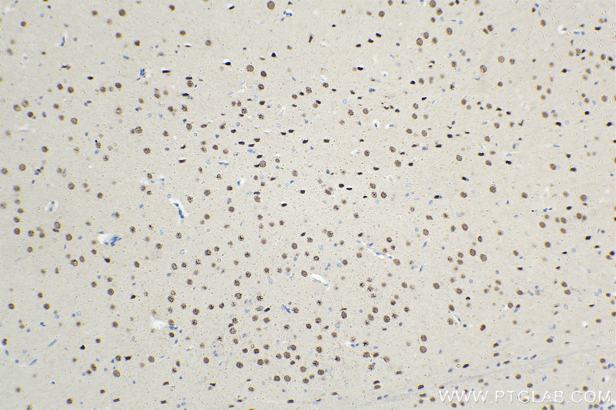 Immunohistochemical analysis of paraffin-embedded rat brain tissue slide using KHC1482 (ACTL6B IHC Kit).