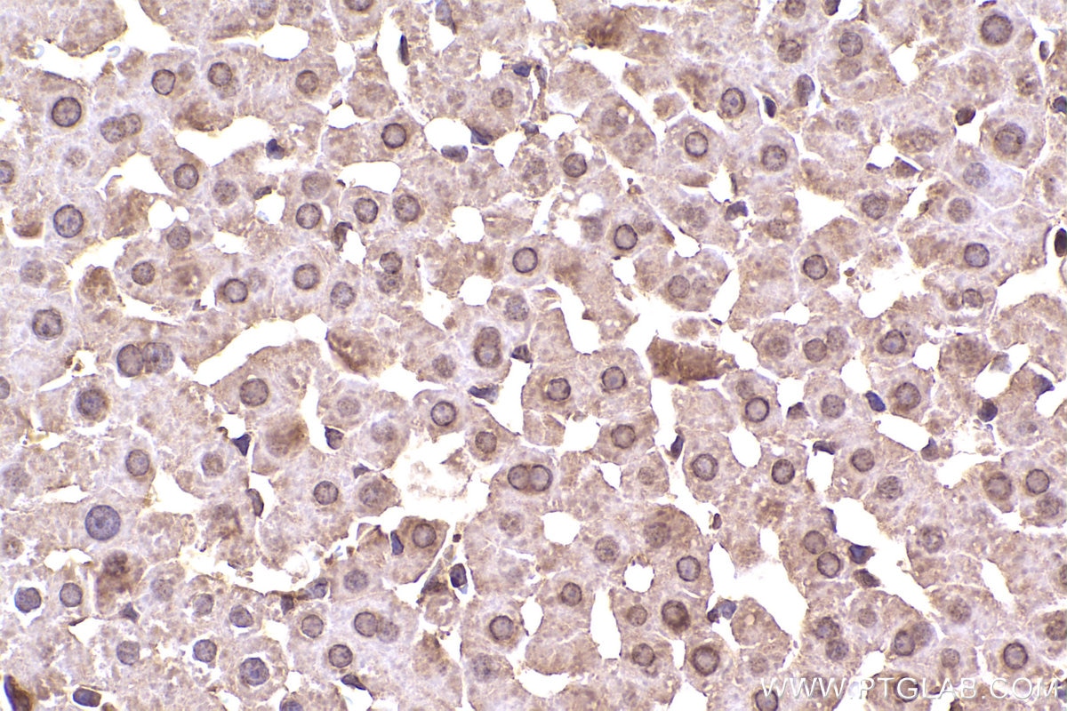 Immunohistochemical analysis of paraffin-embedded rat liver tissue slide using KHC2338 (ACTR1A IHC Kit).