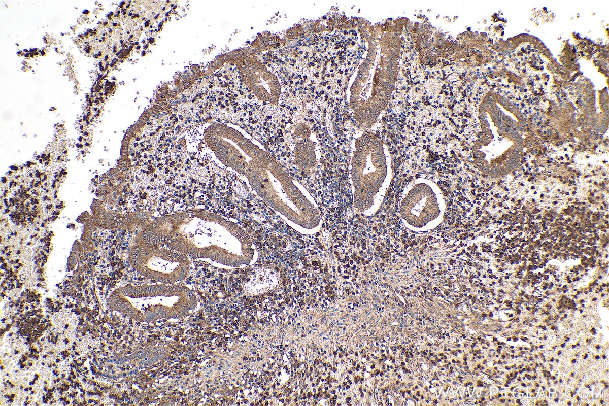 Immunohistochemical analysis of paraffin-embedded human appendicitis tissue slide using KHC0728 (ACTR2 IHC Kit).