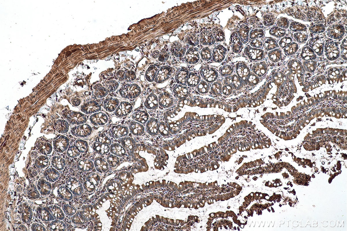 Immunohistochemical analysis of paraffin-embedded rat small intestine tissue slide using KHC0728 (ACTR2 IHC Kit).