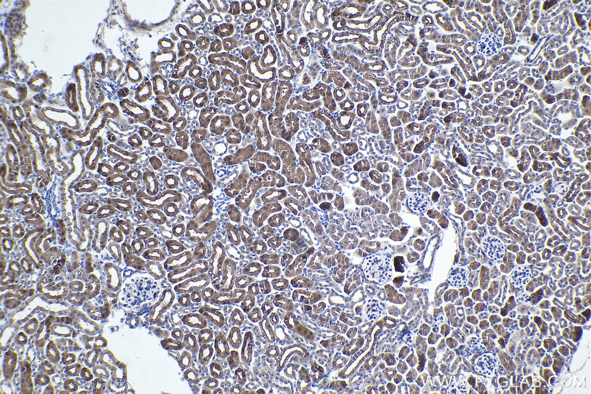 Immunohistochemical analysis of paraffin-embedded mouse kidney tissue slide using KHC1042 (ACY1 IHC Kit).