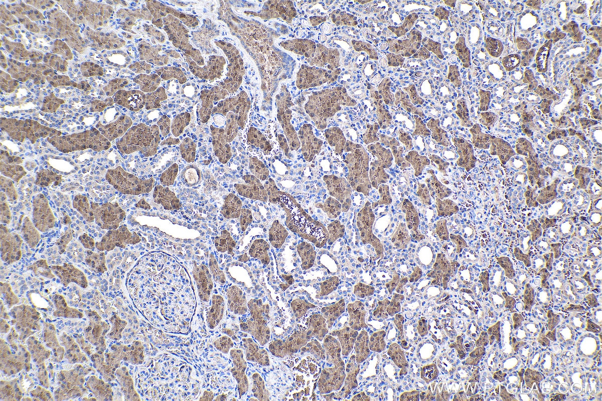 Immunohistochemical analysis of paraffin-embedded human kidney tissue slide using KHC1042 (ACY1 IHC Kit).