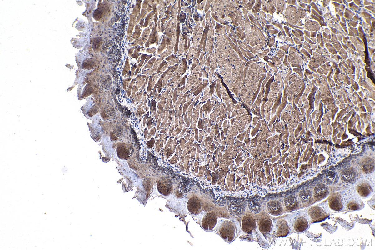 Immunohistochemical analysis of paraffin-embedded mouse tongue tissue slide using KHC1000 (ACYP2 IHC Kit).