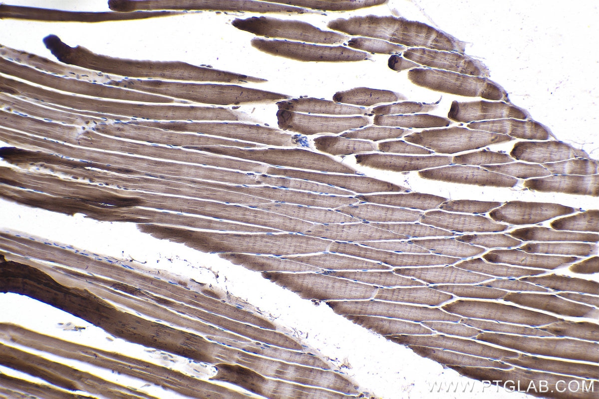 Immunohistochemical analysis of paraffin-embedded rat skeletal muscle tissue slide using KHC1000 (ACYP2 IHC Kit).