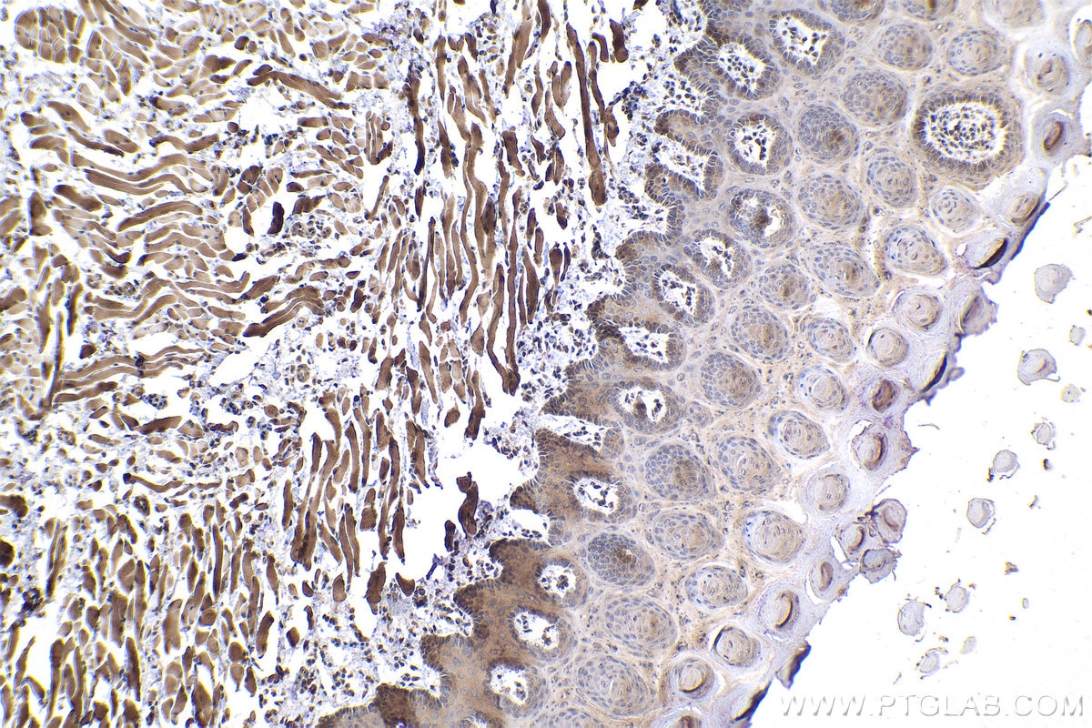 Immunohistochemical analysis of paraffin-embedded rat tongue tissue slide using KHC1000 (ACYP2 IHC Kit).