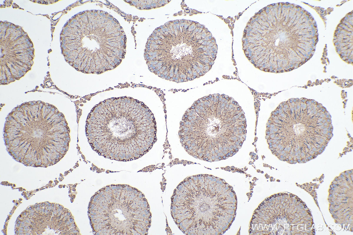 Immunohistochemical analysis of paraffin-embedded rat testis tissue slide using KHC0219 (ADAM10 IHC Kit).