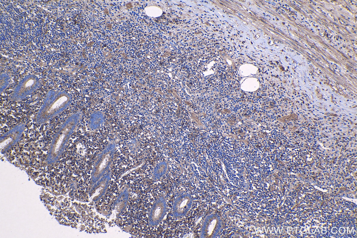 Immunohistochemical analysis of paraffin-embedded human appendicitis tissue slide using KHC1159 (ADAMDEC1 IHC Kit).