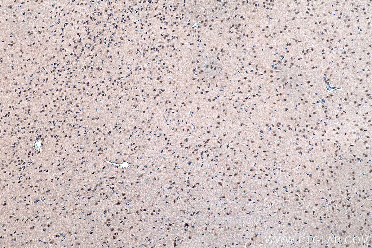 Immunohistochemical analysis of paraffin-embedded rat brain tissue slide using KHC0183 (ADAR1 IHC Kit).