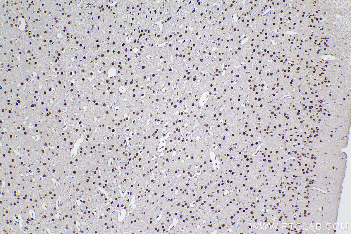 Immunohistochemical analysis of paraffin-embedded mouse brain tissue slide using KHC2368 (ADARB1 IHC Kit).