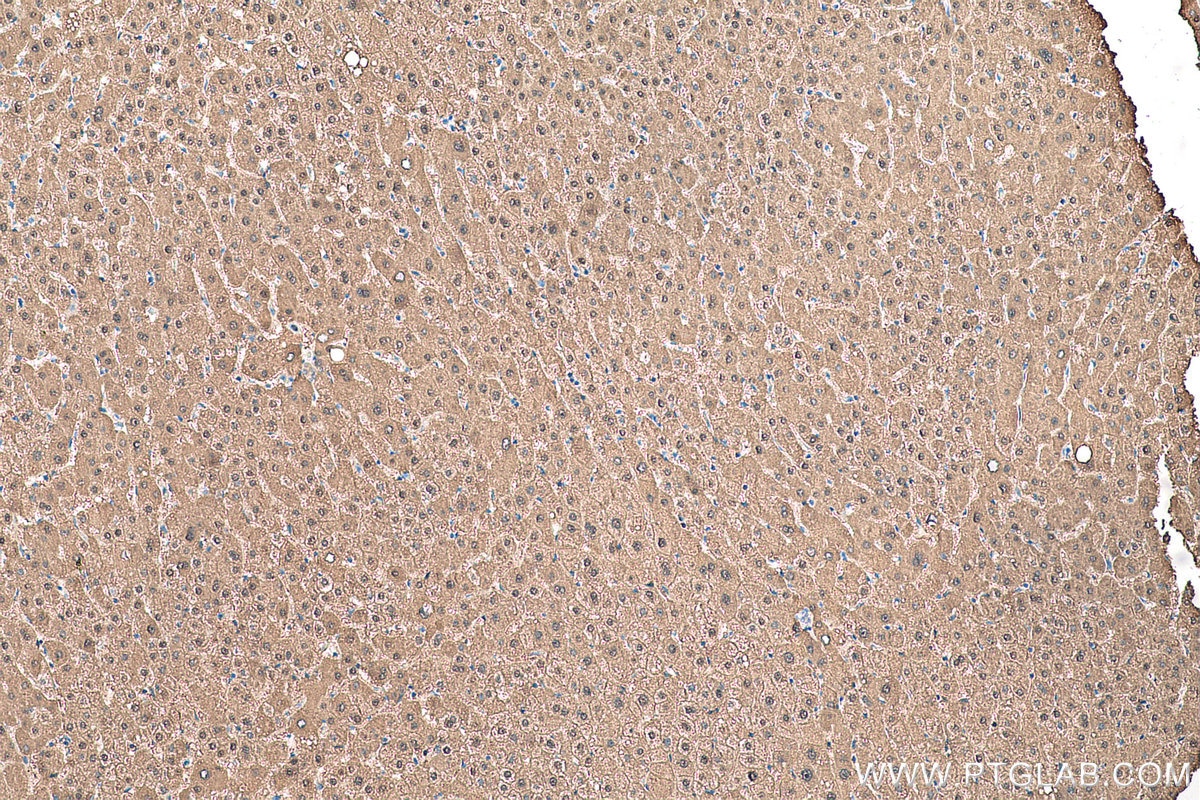 Immunohistochemical analysis of paraffin-embedded human liver tissue slide using KHC0684 (ADH1A IHC Kit).