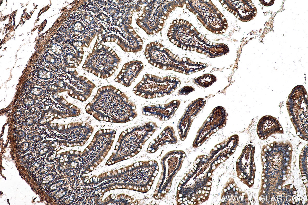 Immunohistochemical analysis of paraffin-embedded human small intestine tissue slide using KHC0684 (ADH1A IHC Kit).