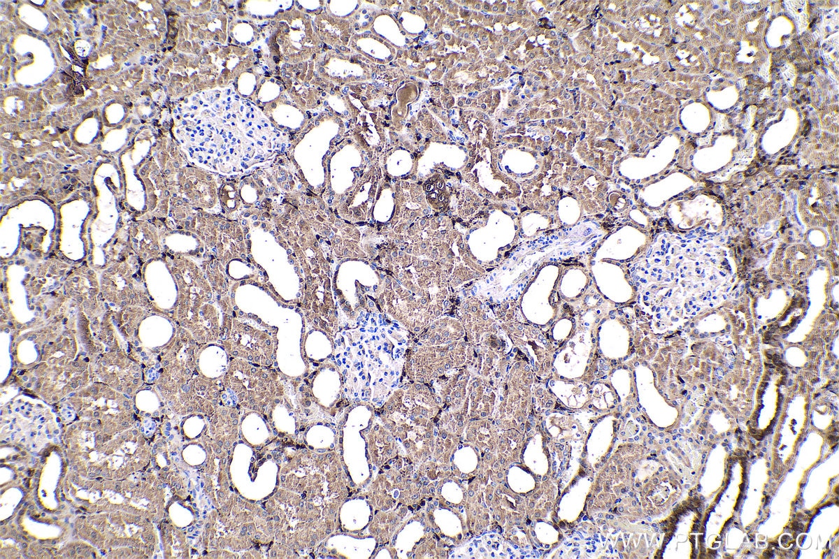 Immunohistochemical analysis of paraffin-embedded human kidney tissue slide using KHC0522 (ADH1C IHC Kit).