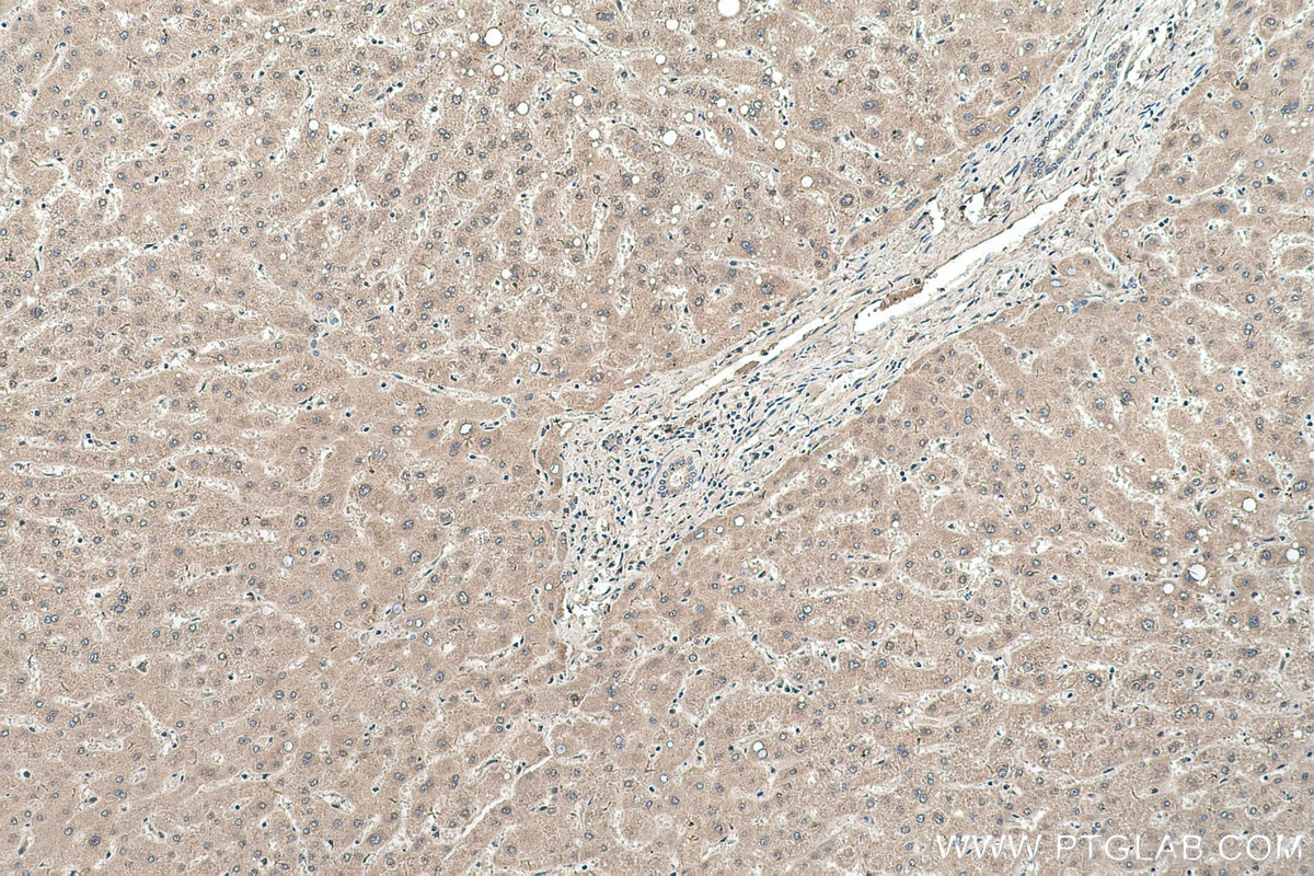 Immunohistochemical analysis of paraffin-embedded human liver tissue slide using KHC0539 (ADH6 IHC Kit).