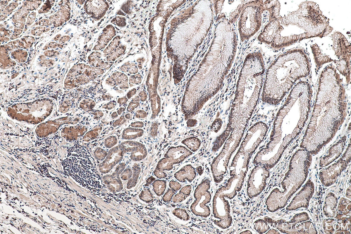 Immunohistochemical analysis of paraffin-embedded human stomach cancer(NAT) tissue slide using KHC0539 (ADH6 IHC Kit).