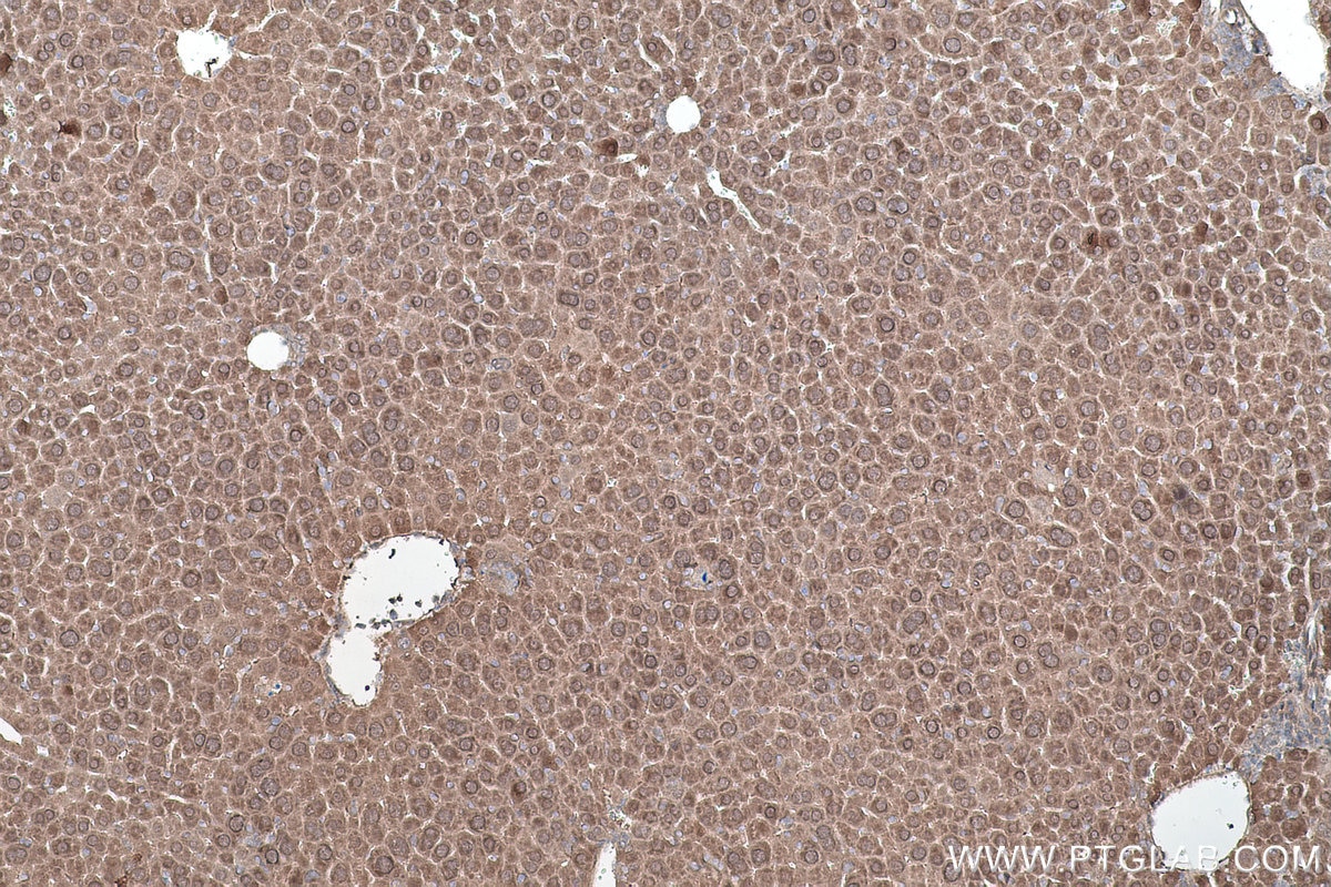 Immunohistochemical analysis of paraffin-embedded mouse liver tissue slide using KHC0539 (ADH6 IHC Kit).