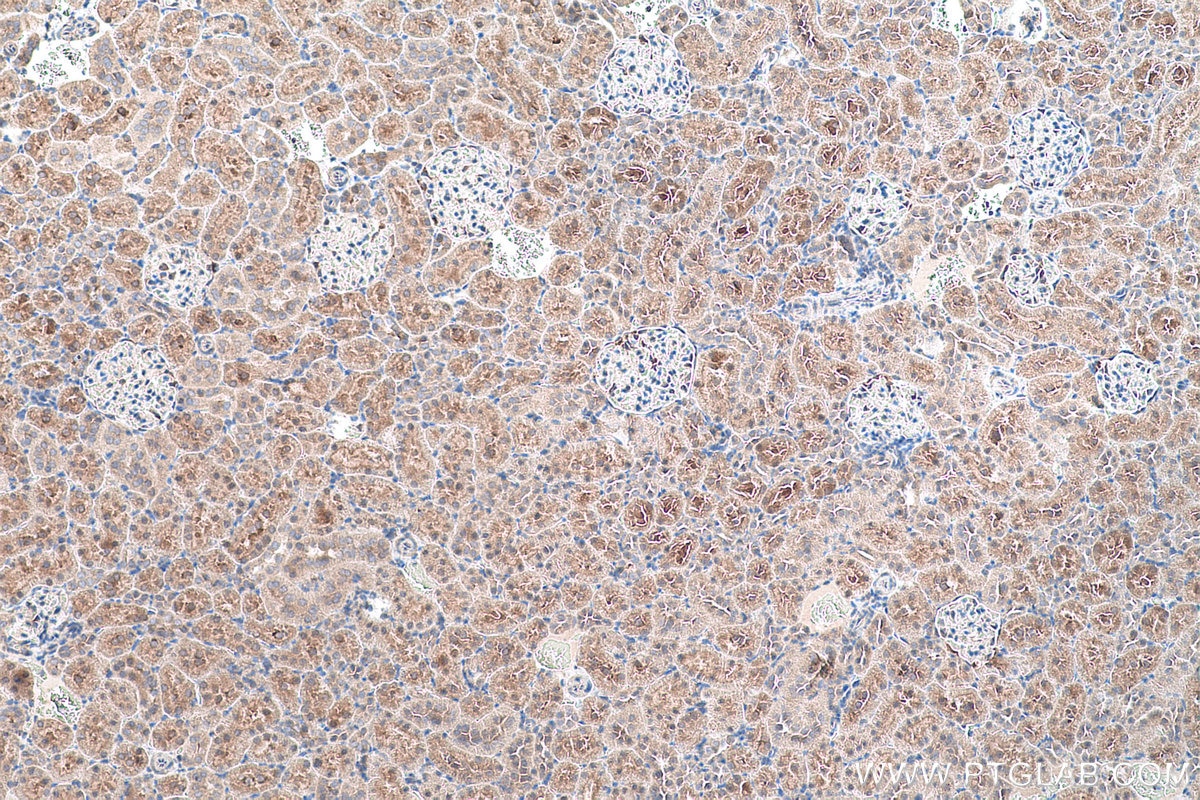 Immunohistochemical analysis of paraffin-embedded rat kidney tissue slide using KHC0539 (ADH6 IHC Kit).