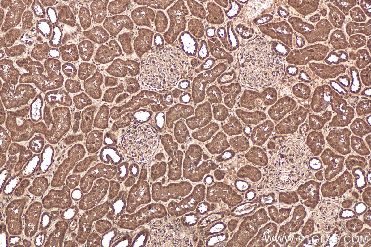 Immunohistochemical analysis of paraffin-embedded human kidney tissue slide using KHC0539 (ADH6 IHC Kit).
