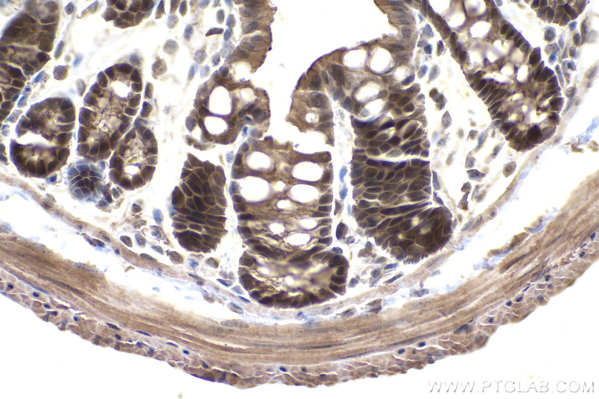 Immunohistochemical analysis of paraffin-embedded mouse colon tissue slide using KHC0916 (ADI1 IHC Kit).