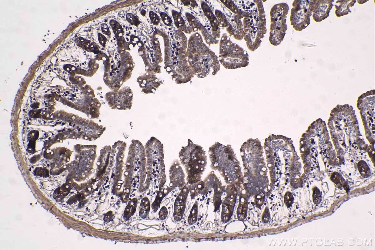 Immunohistochemical analysis of paraffin-embedded mouse small intestine tissue slide using KHC1757 (ADRM1 IHC Kit).